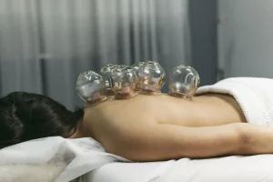 Pose de ventouses (cupping therapy) sur le dos pour soulager les douleurs.